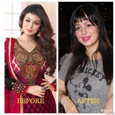 ayesha takia before surgery|mayesha takia plastic surgery.